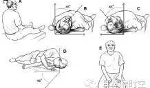 耳石症手法复位视频,耳石症手法复位操作步骤详解